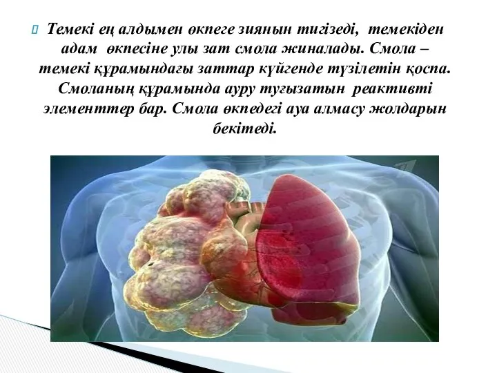 Темекі ең алдымен өкпеге зиянын тигізеді, темекіден адам өкпесіне улы зат