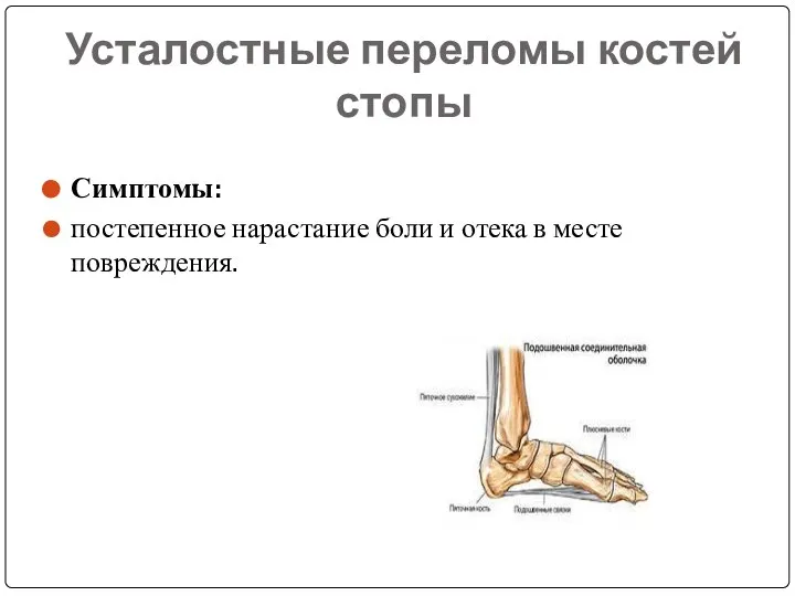 Усталостные переломы костей стопы Симптомы: постепенное нарастание боли и отека в месте повреждения.