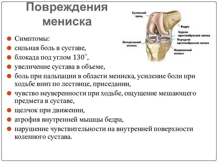 Повреждения мениска Симптомы: сильная боль в суставе, блокада под углом 130°,