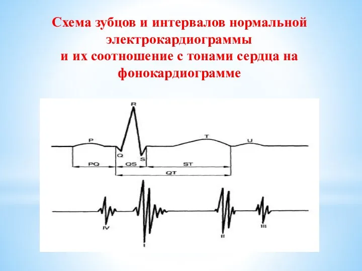 Схема зубцов и интервалов нормальной электрокардиограммы и их соотношение с тонами сердца на фонокардиограмме