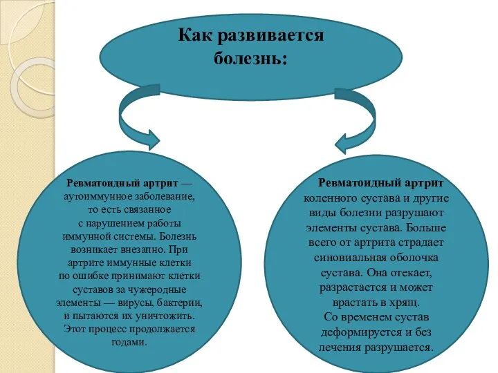 Как развивается болезнь: Ревматоидный артрит — аутоиммунное заболевание, то есть связанное