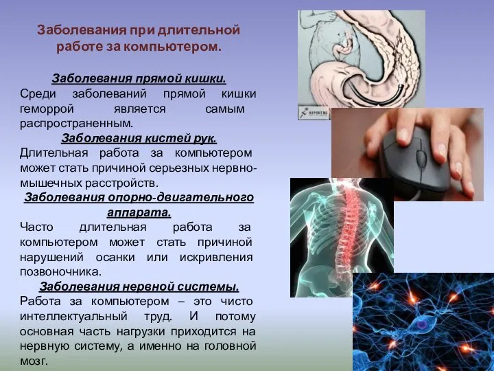 Заболевания при длительной работе за компьютером. Заболевания прямой кишки. Среди заболеваний