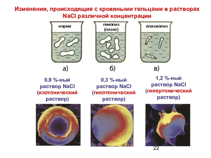 Изменения, происходящие с кровяными тельцами в растворах NaCl различной концентрации норма