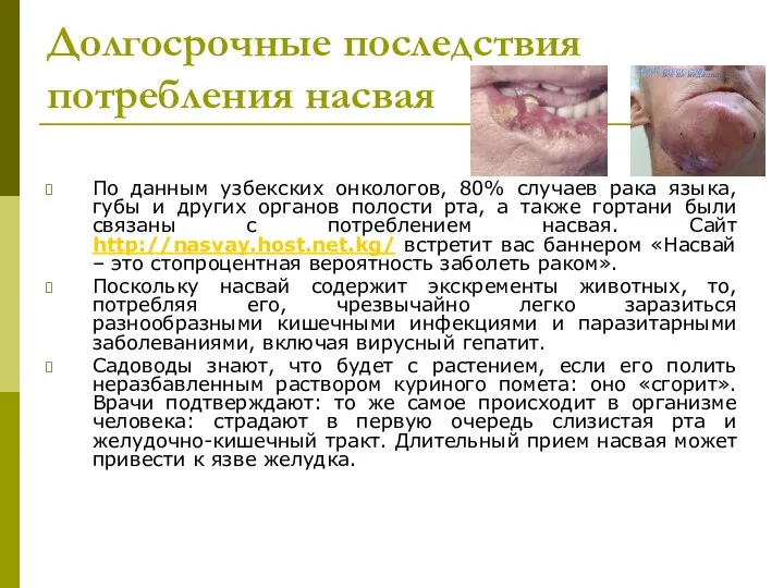 Долгосрочные последствия потребления насвая По данным узбекских онкологов, 80% случаев рака