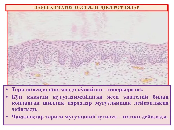 Тери юзасида шох модда кўпайган - гиперкератоз. Кўп қаватли мугузланмайдиган ясси