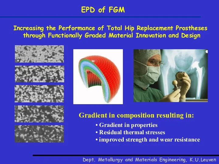 EPD of FGM Increasing the Performance of Total Hip Replacement Prostheses