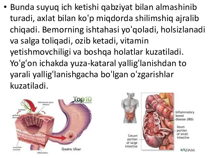 Bunda suyuq ich ketishi qabziyat bilan almashinib turadi, axlat bilan koʻp