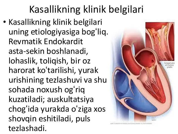 Kasallikning klinik belgilari Kasallikning klinik belgilari uning etiologiyasiga bogʻliq. Revmatik Endokardit