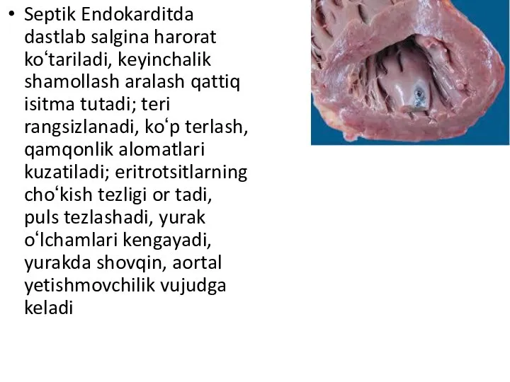 Septik Endokarditda dastlab salgina harorat koʻtariladi, keyinchalik shamollash aralash qattiq isitma