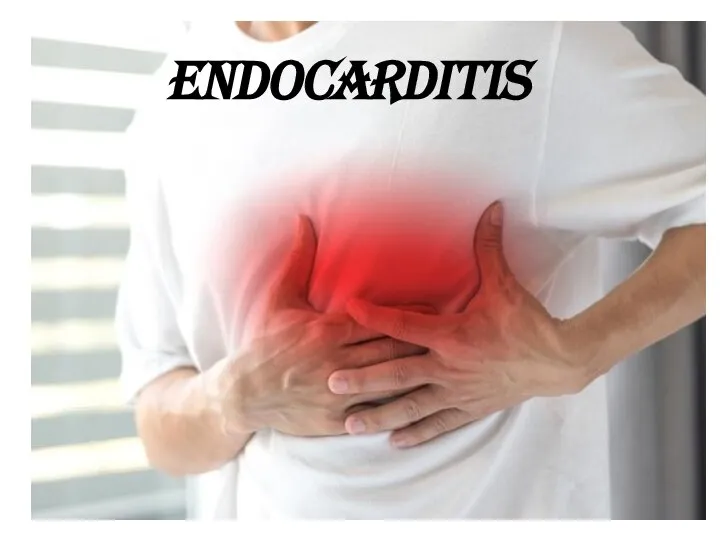 ENDOCARDITIS