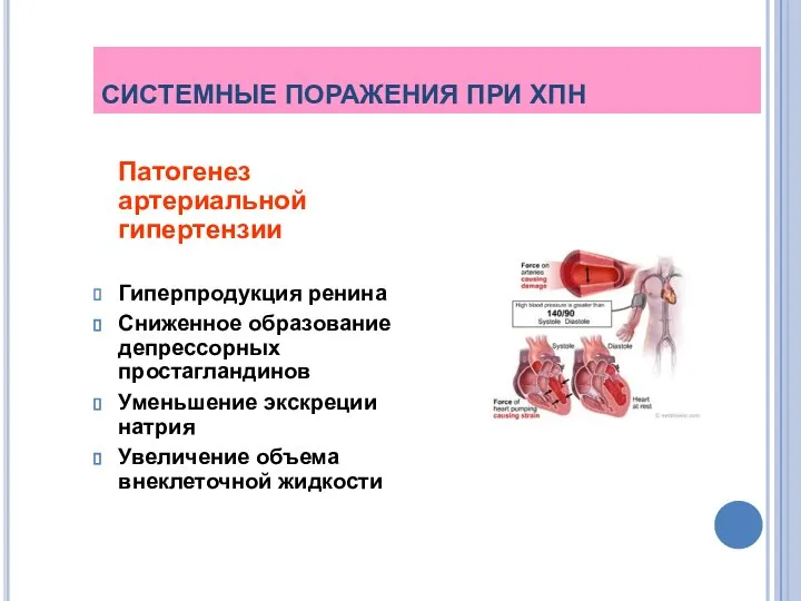СИСТЕМНЫЕ ПОРАЖЕНИЯ ПРИ ХПН Патогенез артериальной гипертензии Гиперпродукция ренина Сниженное образование