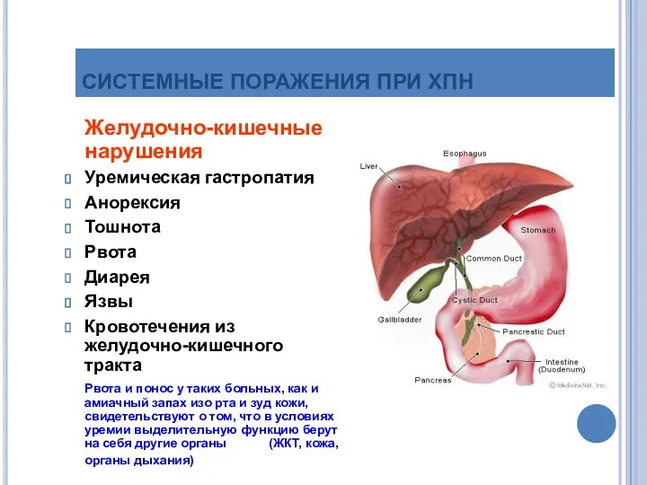 СИСТЕМНЫЕ ПОРАЖЕНИЯ ПРИ ХПН Желудочно-кишечные нарушения Уремическая гастропатия Анорексия Тошнота Рвота