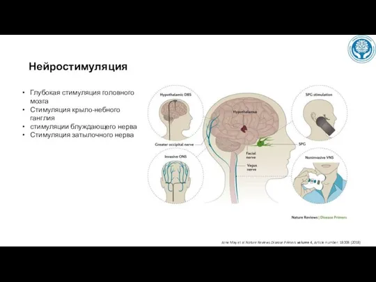 Нейростимуляция Arne May et al Nature Reviews Disease Primers volume 4,