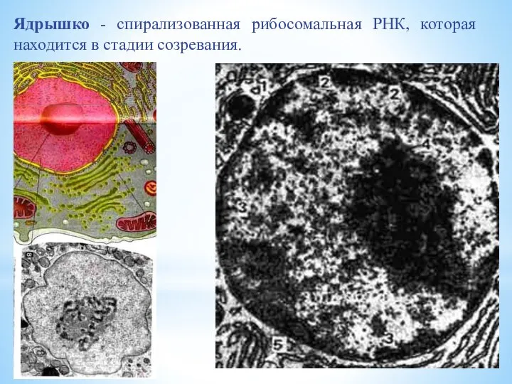 Ядрышко - спирализованная рибосомальная РНК, которая находится в стадии созревания.