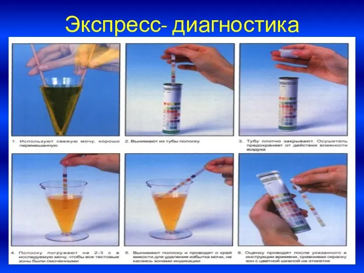 Экспресс- диагностика