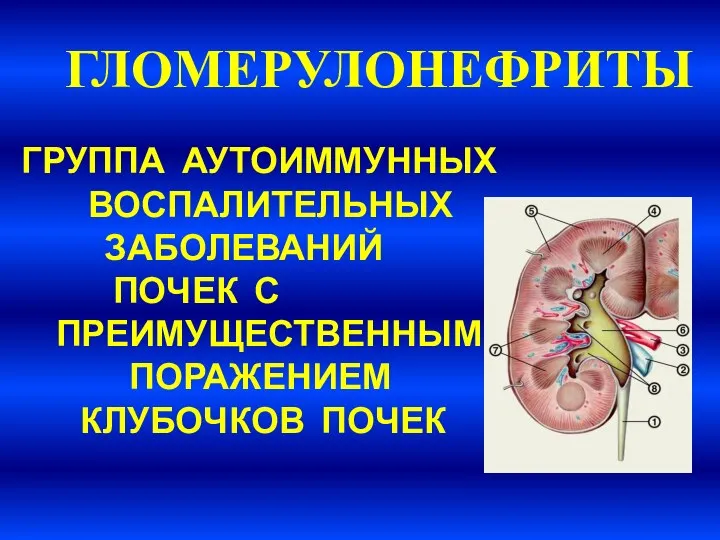 ГЛОМЕРУЛОНЕФРИТЫ ГРУППА АУТОИММУННЫХ ВОСПАЛИТЕЛЬНЫХ ЗАБОЛЕВАНИЙ ПОЧЕК С ПРЕИМУЩЕСТВЕННЫМ ПОРАЖЕНИЕМ КЛУБОЧКОВ ПОЧЕК