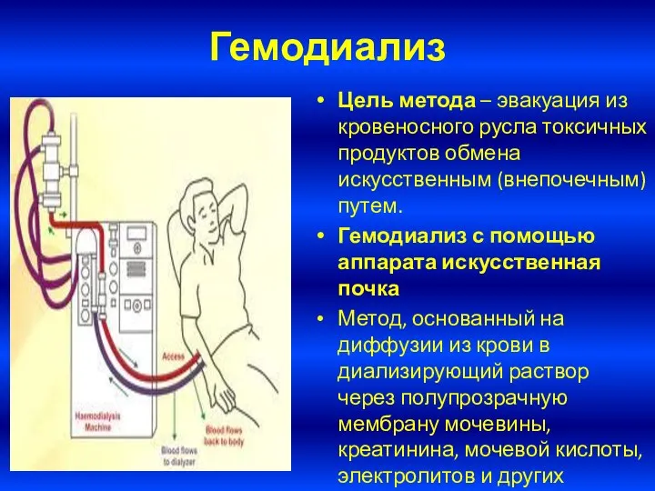 Гемодиализ Цель метода – эвакуация из кровеносного русла токсичных продуктов обмена