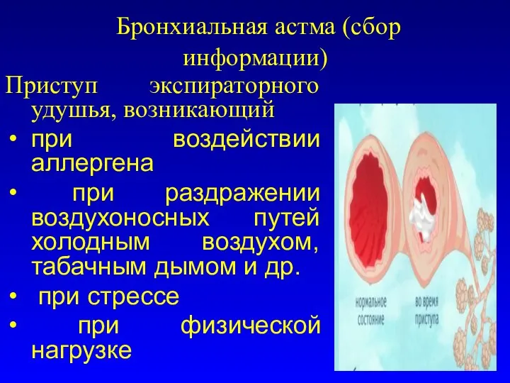 Бронхиальная астма (сбор информации) Приступ экспираторного удушья, возникающий при воздействии аллергена