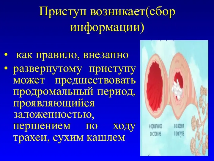 Приступ возникает(сбор информации) как правило, внезапно развернутому приступу может предшествовать продромальный