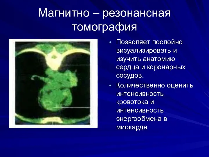 Магнитно – резонансная томография Позволяет послойно визуализировать и изучить анатомию сердца