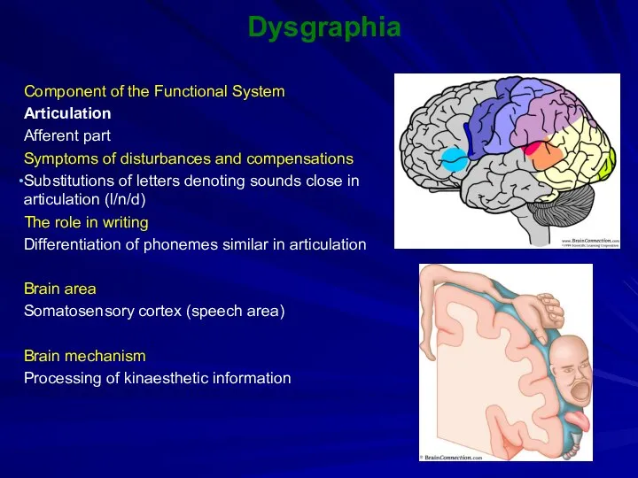 Dysgraphia Component of the Functional System Articulation Afferent part Symptoms of