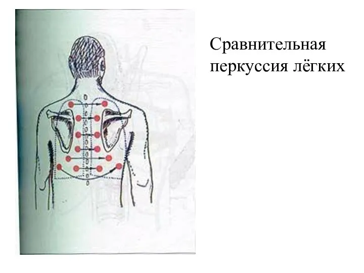 Сравнительная перкуссия лёгких