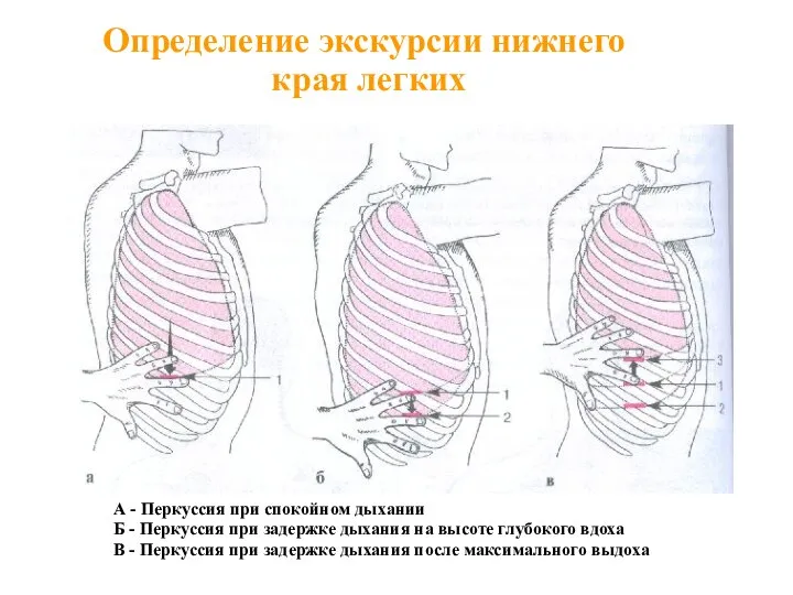 Определение экскурсии нижнего края легких А - Перкуссия при спокойном дыхании