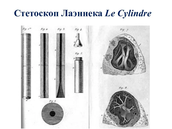 Стетоскоп Лаэннека Le Cylindre