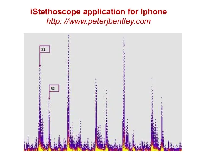 iStethoscope application for Iphone http: //www.peterjbentley.com