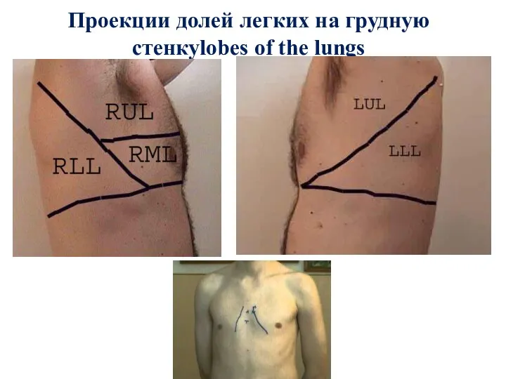 Проекции долей легких на грудную стенкуlobes of the lungs