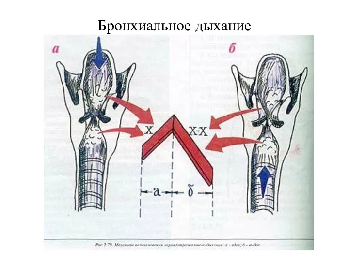 Бронхиальное дыхание