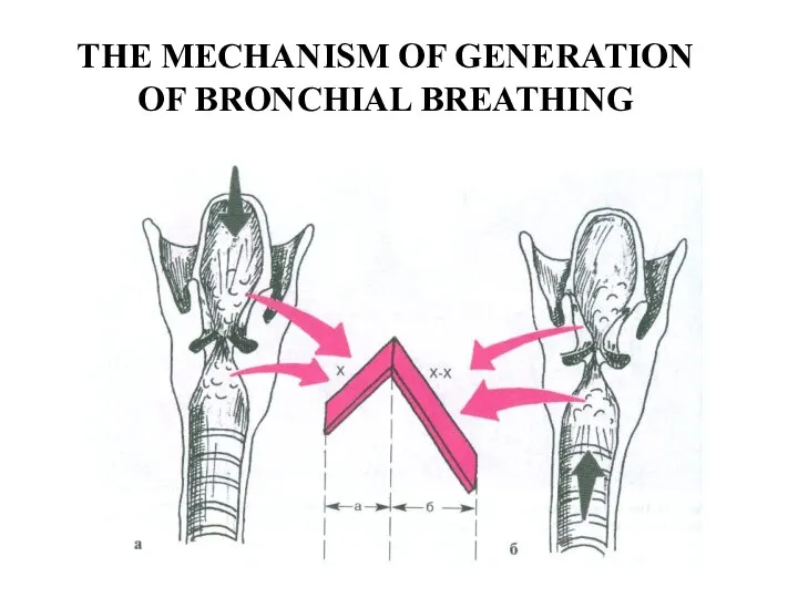 THE MECHANISM OF GENERATION OF BRONCHIAL BREATHING