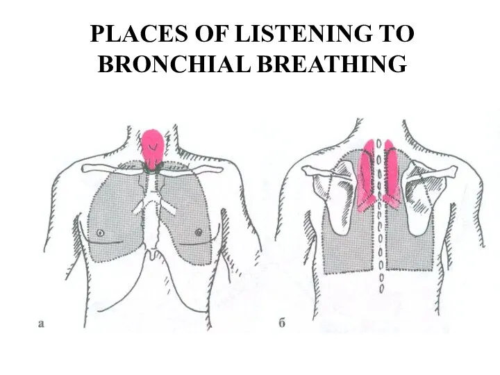 PLACES OF LISTENING TO BRONCHIAL BREATHING