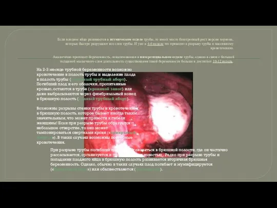 Если плодное яйцо развивается в истмическом отделе трубы, то имеет место
