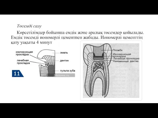 Төсемді салу Көрсетілімдер бойынша емдік және аралық төсемдер қойылады. Емдік төсемді