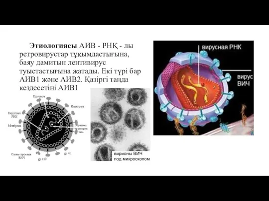 Этиологиясы АИВ - РНҚ - лы ретровирустар тұқымдастығына, баяу дамитын лентивирус