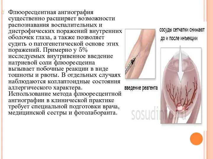 Флюоресцентная ангиография существенно расширяет возможности распознавания воспалительных и дистрофических поражений внутренних