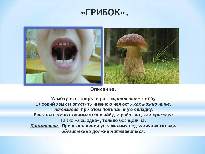 «ГРИБОК». Описание. Улыбнуться, открыть рот, «приклеить» к нёбу широкий язык и