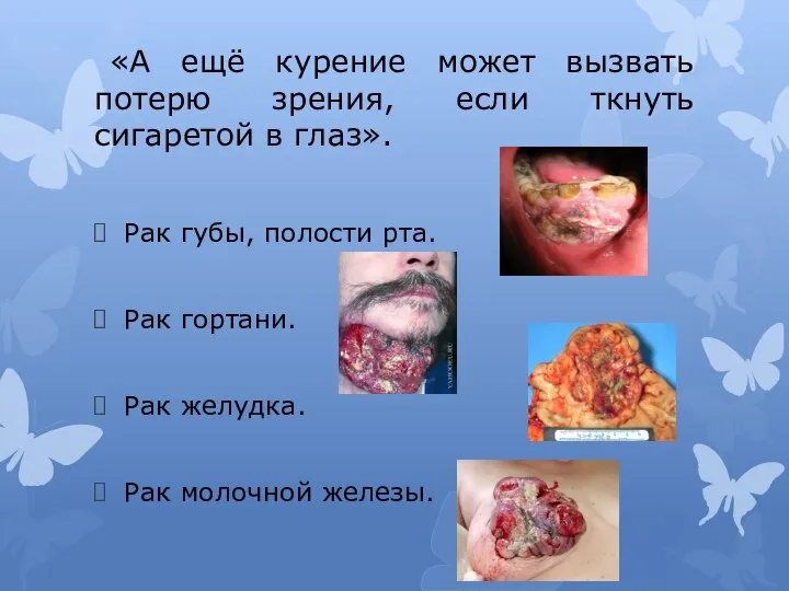 «А ещё курение может вызвать потерю зрения, если ткнуть сигаретой в