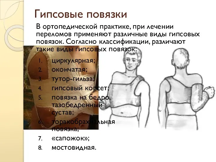 Гипсовые повязки циркулярная; окончатая; тутор-гильза; гипсовый корсет; повязка на бедро, тазобедренный