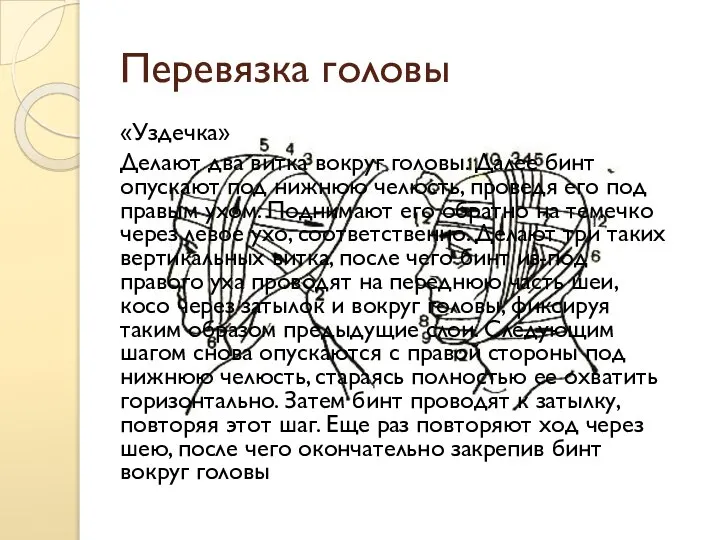 Перевязка головы «Уздечка» Делают два витка вокруг головы. Далее бинт опускают