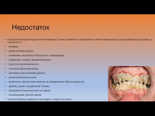 Недостаток Слишком большой недостаток витамина С может привести к признакам и