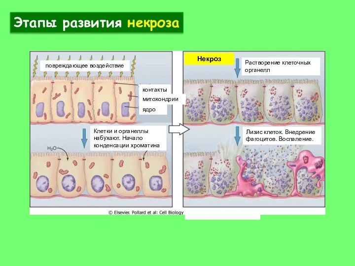 контакты митохондрии ядро повреждающее воздействие Некроз Клетки и органеллы набухают. Начало