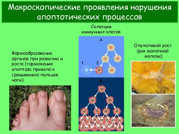 Макроскопические проявления нарушения апоптотических процессов Формообразование органов при развитии и росте