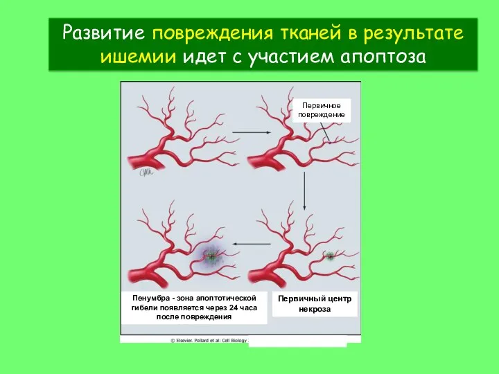 Развитие повреждения тканей в результате ишемии идет с участием апоптоза