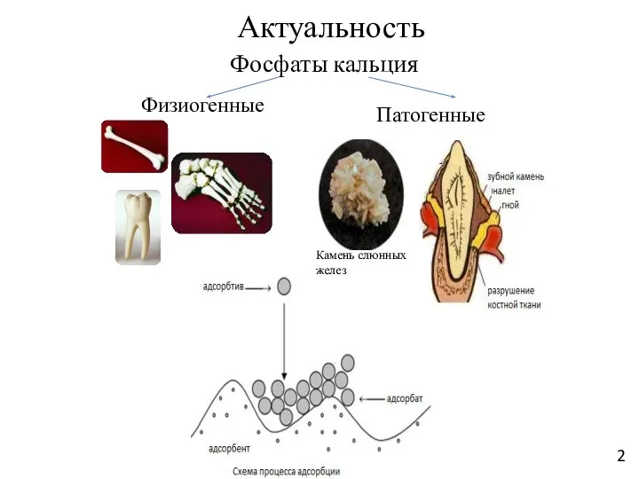 Актуальность Фосфаты кальция Патогенные Физиогенные Камень слюнных желез