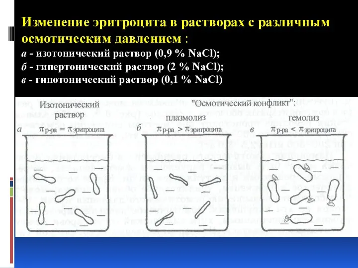 Изменение эритроцита в растворах с различным осмотическим давлением : а -