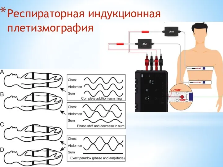 Респираторная индукционная плетизмография