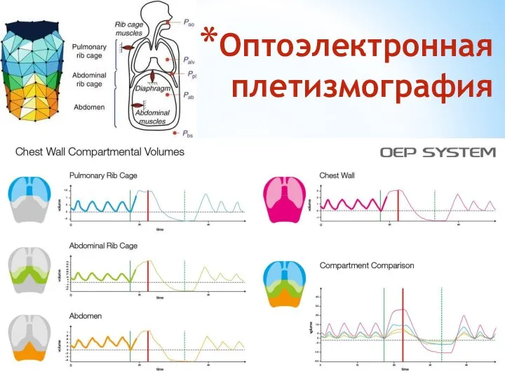 Оптоэлектронная плетизмография