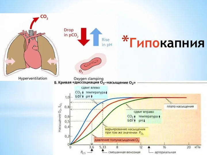 Гипокапния